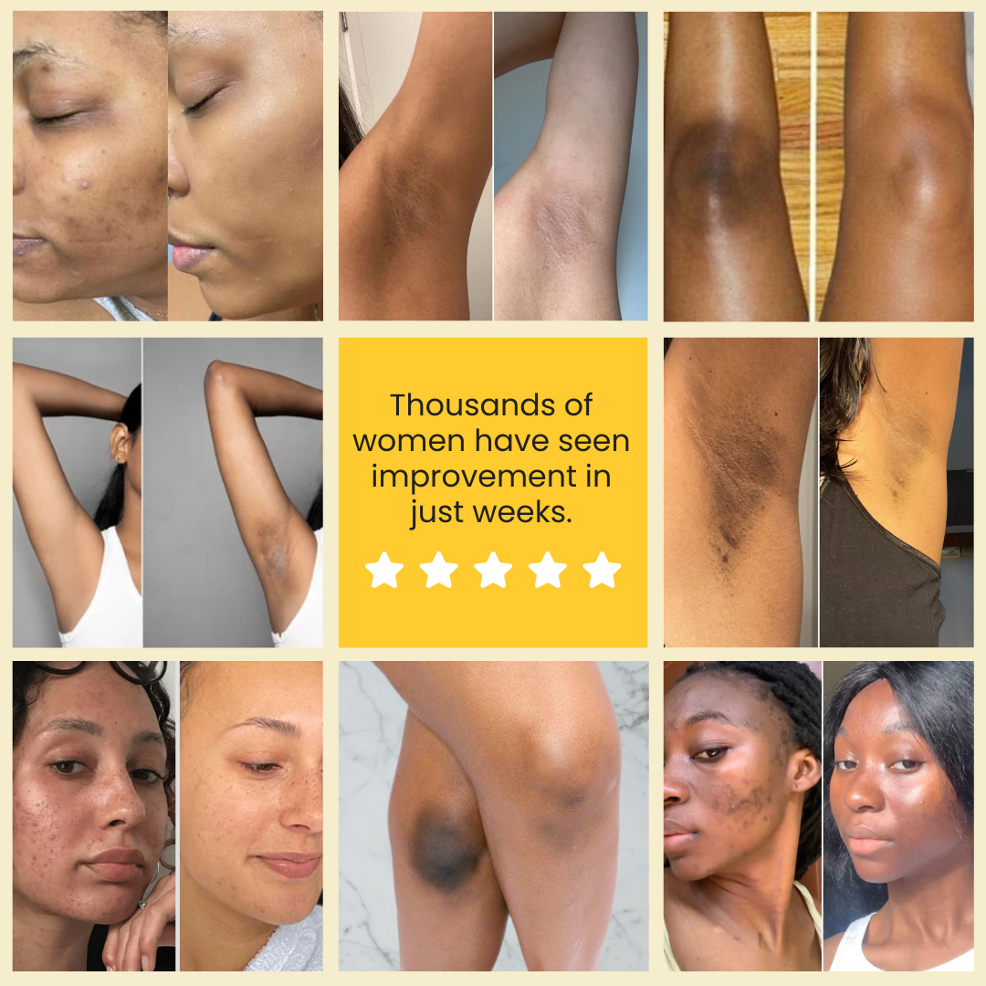 Lemon Turmeric & Kojic Acid Brightening Soap