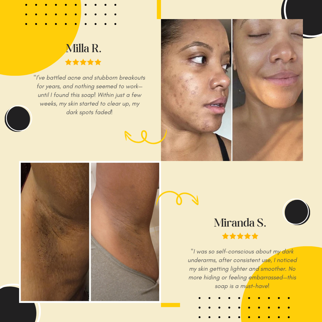 Lemon Turmeric & Kojic Acid Brightening Soap